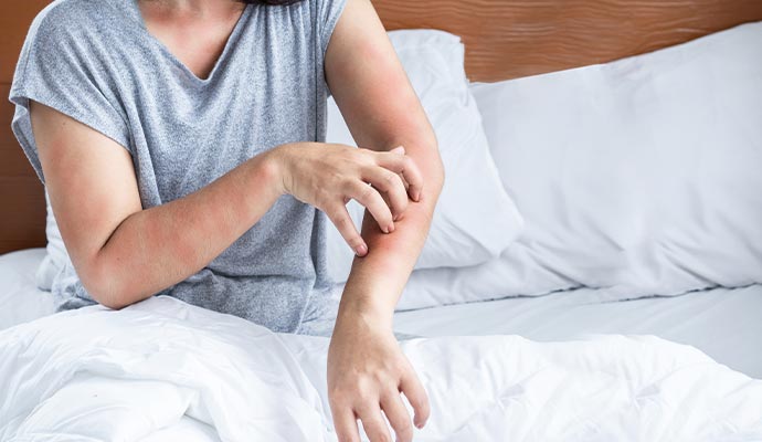 A woman sitting on bed scratching arm