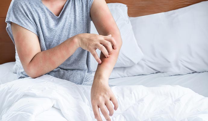 Woman affected by allergy problem